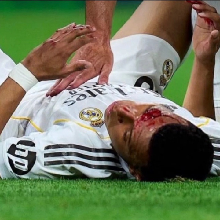 500彩票网部门-阿斯报：姆巴佩将首发出战拜仁，他不会佩戴面具